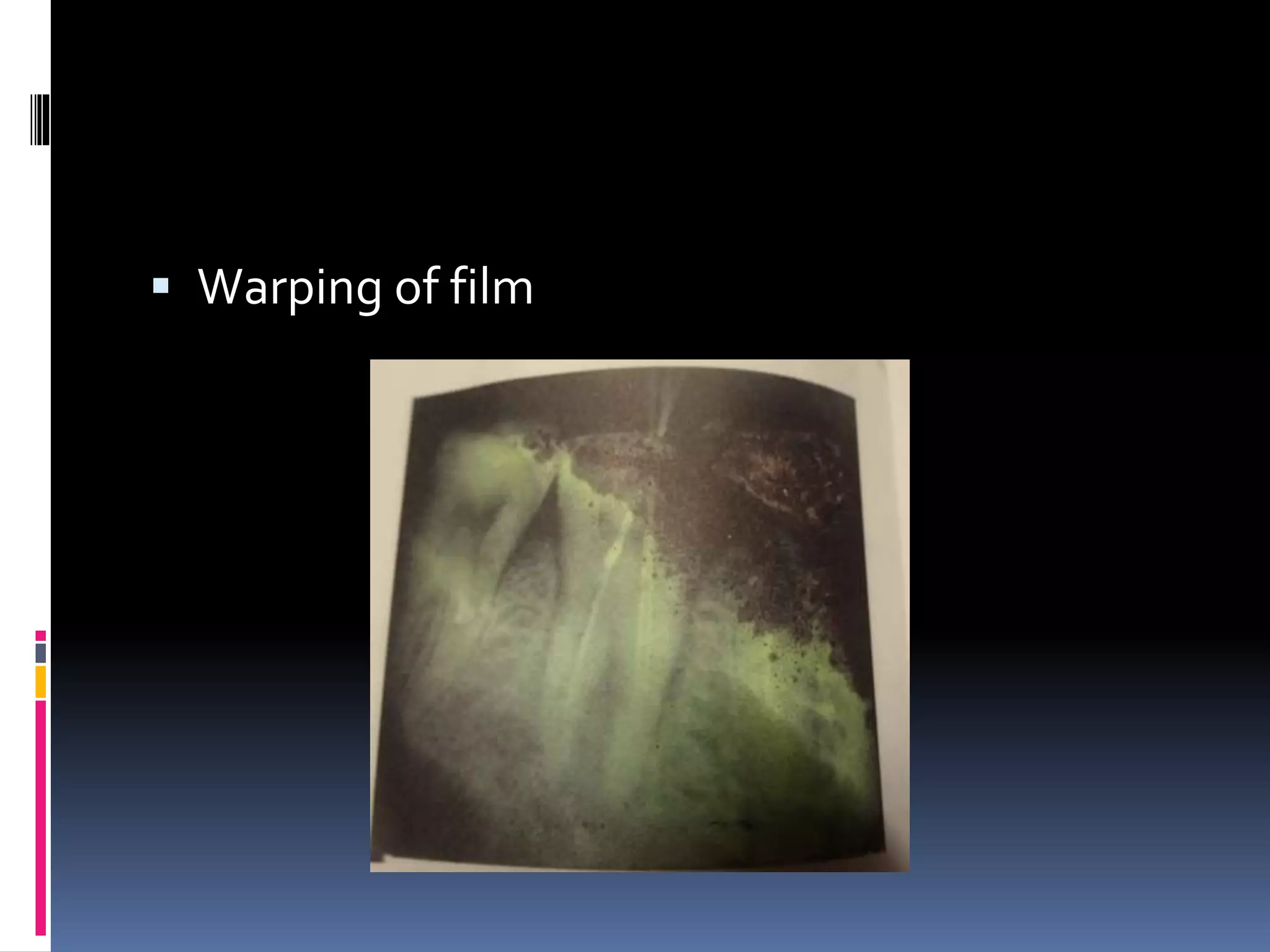 Faulty radiographs | PPTX