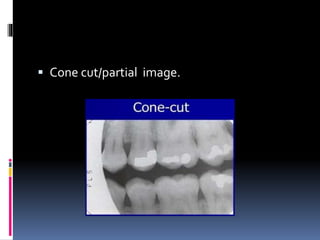  Cone cut/partial image.
 