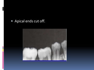 Apical ends cut off.
 