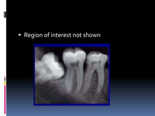  Region of interest not shown
 