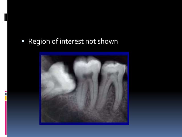 Faulty radiographs | PPTX | Dental Health | Diseases and Conditions