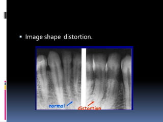  Image shape distortion.
 