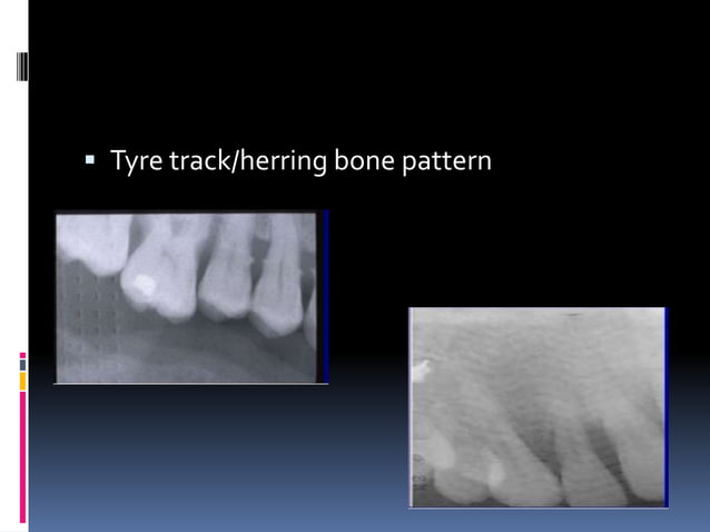 Faulty radiographs | PPTX | Dental Health | Diseases and Conditions