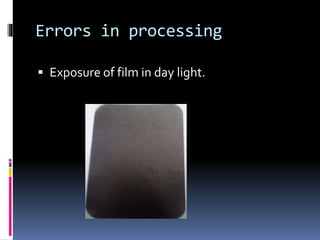 Errors in processing
 Exposure of film in day light.
 