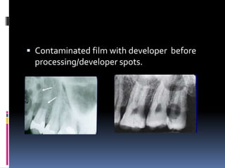  Contaminated film with developer before
processing/developer spots.
 