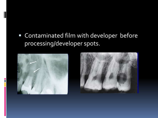 Faulty radiographs | PPTX | Dental Health | Diseases and Conditions