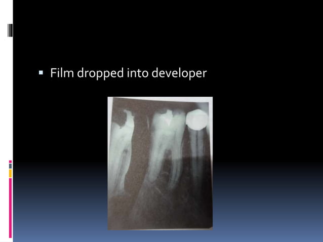 Faulty radiographs | PPTX | Dental Health | Diseases and Conditions