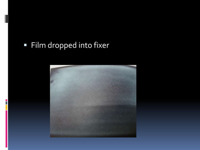 Faulty radiographs | PPTX | Dental Health | Diseases and Conditions