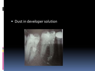  Dust in developer solution
 