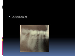  Dust in fixer
 
