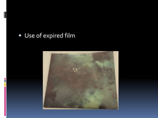  Use of expired film
 