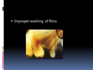  Improper washing of films
 