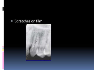  Scratches on film
 