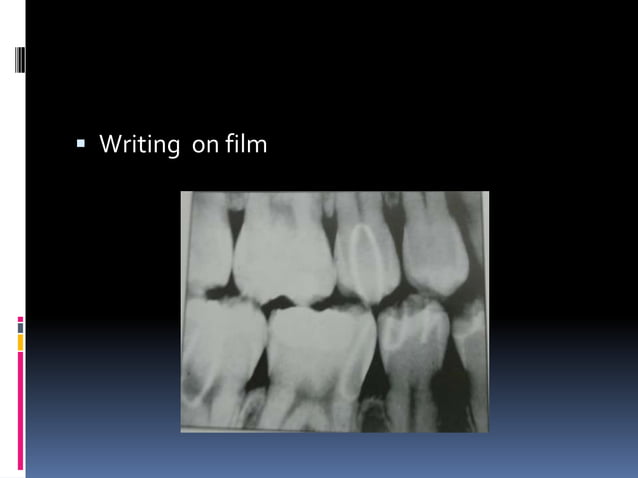 Faulty radiographs | PPTX | Dental Health | Diseases and Conditions