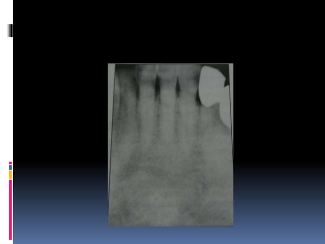 Faulty radiographs | PPTX | Dental Health | Diseases and Conditions