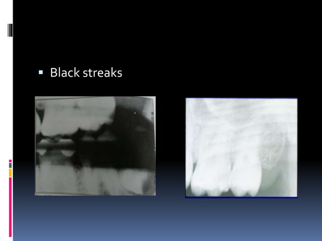 Faulty radiographs | PPTX | Dental Health | Diseases and Conditions