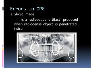 Errors in OPG
1)Ghost image
is a radiopaque artifact produced
when radiodense object is penetrated
twice.
 
