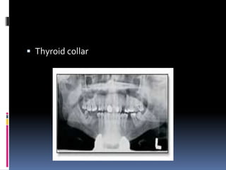  Thyroid collar
 