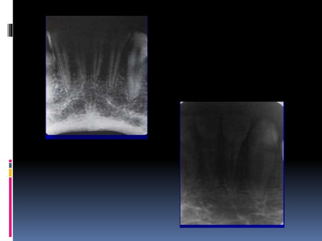 Faulty radiographs | PPTX | Dental Health | Diseases and Conditions