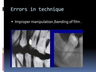 Errors in technique
 Improper manipulation /bending of film .
 