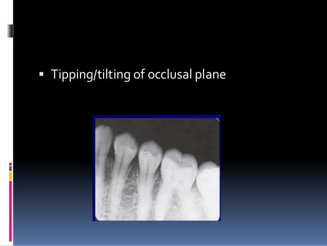 Faulty radiographs