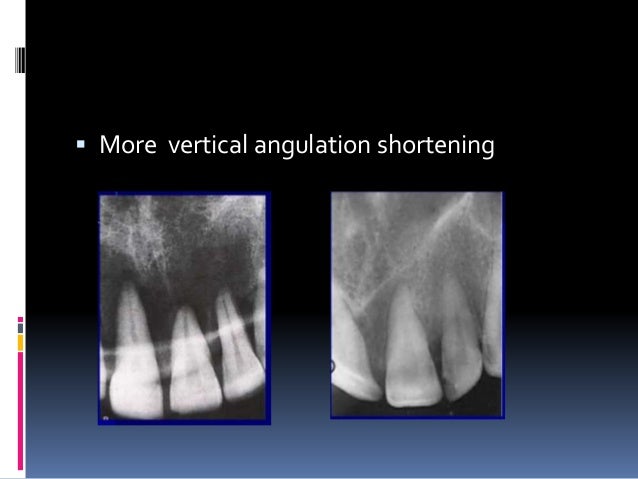 Faulty radiographs