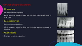 faulty radiographs and radiographic artifacts.pptx