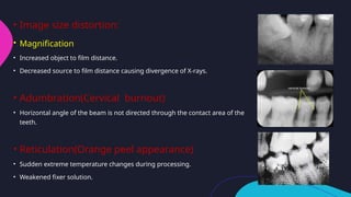 Film Developing Reticulation faulty radiographs and radiographic artifacts.pptx