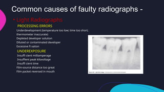 faulty radiographs and radiographic artifacts.pptx
