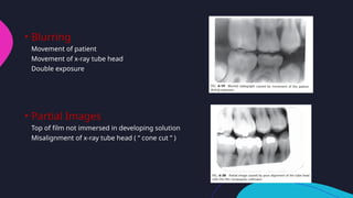 Undercut Radiograph faulty radiographs and radiographic artifacts.pptx