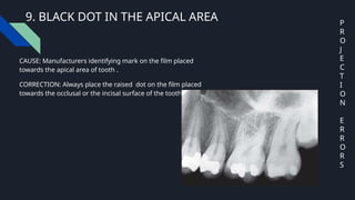FAULTY RADIOGRAPHS IN DENTISTRY PPTX. | PPTX