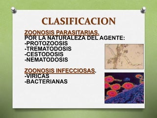 CLASIFICACION
ZOONOSIS PARASITARIAS.
POR LA NATURALEZA DEL AGENTE:
-PROTOZOOSIS
-TREMATODOSIS
-CESTODOSIS
-NEMATODOSIS
ZOONOSIS INFECCIOSAS.
-VIRICAS
-BACTERIANAS
 