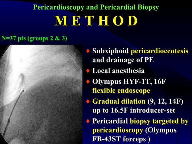 192 pericardioscopy and pericardial biopsy | PPT