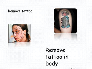 Remove tattoo




                Remove
                tattoo in
                body
 