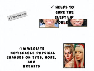  Helps To
                      Cure The
                      Cleft Lip
                     Problem




     I m m e d i a t e
  Noticeable Physical
Changes On Eyes, Nose,
          And
        Breasts
 
