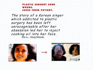 Plastic surgery gone
      wrong.
      Ca s e s f r o m pa t ie n t.

The story of a Korean singer
which addicted to plastic
surgery has been left
unrecognisable after her
obsession led her to inject
cooking oil into her face.
     She is… Hang Miouku
 