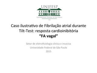 Caso	
  ilustra+vo	
  de	
  Fibrilação	
  atrial	
  durante	
  
Tilt-­‐Test:	
  resposta	
  cardioinibitória	
  
“FA	
  vagal”	
  
Setor	
  de	
  eletroﬁsiologia	
  clínica	
  e	
  invasiva	
  
Univesidade	
  Federal	
  de	
  São	
  Paulo	
  
2015	
  
 