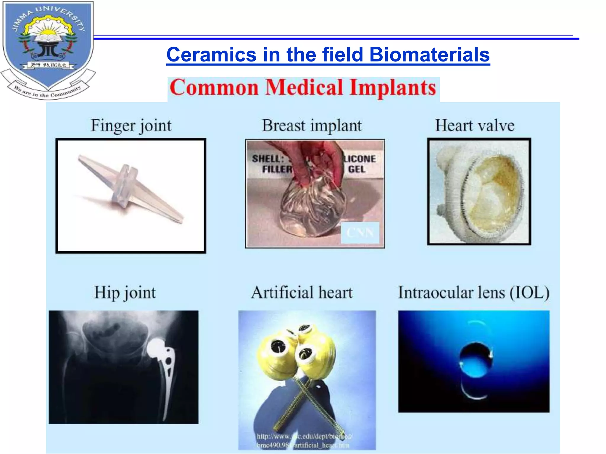 Ceramics in the field Biomaterials
 