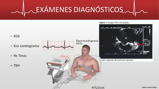 EXÁMENES DIAGNÓSTICOS 
 ECG 
 Eco cardiograma 
 Rx Tórax 
 TSH 
Diseño: Andrés Zúñiga 
 