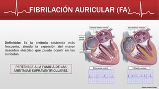 FIBRILACIÓN AURICULAR (FA) 
Definición: Es la arritmia sostenida más 
frecuente, siendo la expresión del mayor 
desorden eléctrico que puede ocurrir en las 
aurículas. 
PERTENECE A LA FAMILIA DE LAS 
ARRITMIAS SUPRAVENTRICULARES. 
Diseño: Andrés Zúñiga 
 