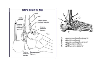 1. Lig peroneoastragalino posterior
2. Lig peroneocalcáneo
3. Lig peroneoastragalino anterior
4. Lig tibioperoneo inferior
5. Lig tibioperoneo posterior
1
5 4
3
2
 