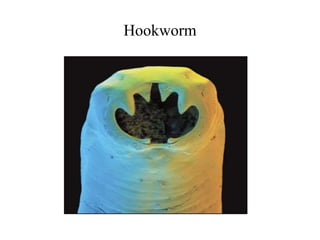 Hookworm
 
