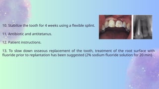 Comprehensive Guide to Avulsion and Storage Media for Avulsed Teeth | PPTX