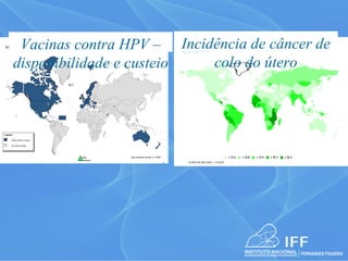 Vacinas contra HPV – Incidência de câncer de
 HPV Vaccines – A Global View of Public Sector Funding Decisions



          disponibilidade e custeio  colo do útero


                              Cayman Is.




Legend:

      Public Sector Funding

      No public funding




                                                         Last reviewed January 12, 2009

                                                                                          6
 