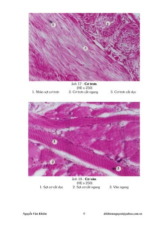 Nguyễn Văn Khiêm drkhiemnguyen@yahoo.com.vn9
¶nh 17 : C¬ tr¬n
(HE x 250)
1. Nh©n sîi c¬ tr¬n 2. C¬ tr¬n c¾t ngang 3. C¬ tr¬n c¾t däc
¶nh 18 : C¬ v©n
(HE x 250)
1. Sîi c¬ c¾t däc 2. Sîi c¬ c¾t ngang 3. V©n ngang
fb.com/HoiMeSachCoMaLuoi
 