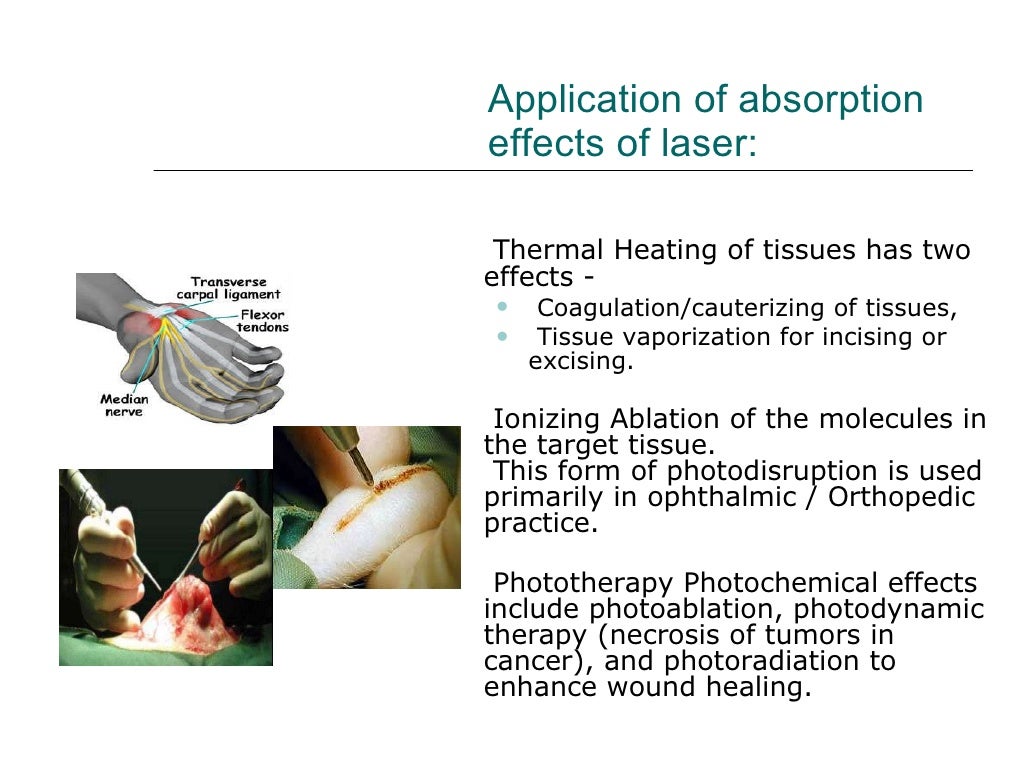 Laser On Soft Tissue.