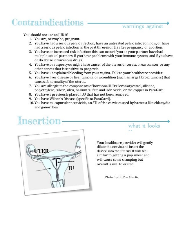 iud information sheet iud information sheet
