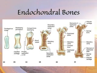 EEnnddoocchhoonnddrraall BBoonneess 
 