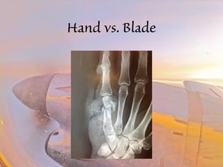 Hand vs. Blade 
 