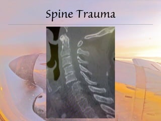 Spine Trauma 
 